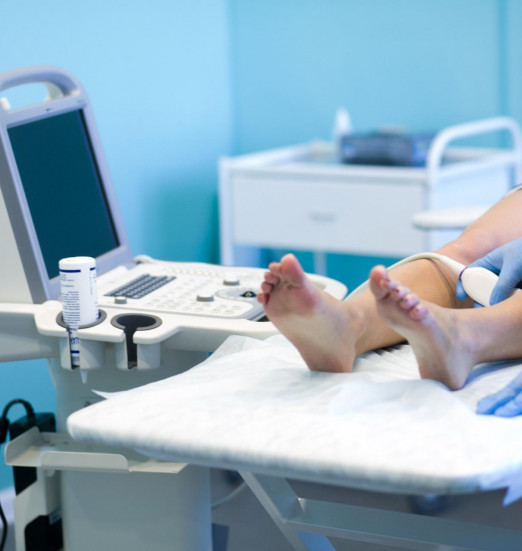 УЗИ сосудов: вены и артерии